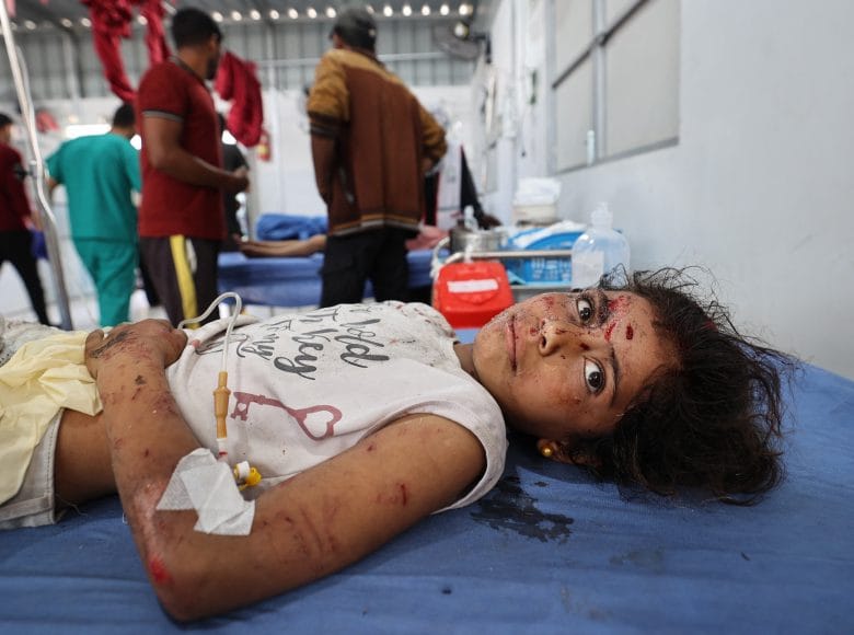 EDITORS NOTE: Graphic content / A wounded girl receives treatment at Al-Awda Hospital at the Nuseirat refugee camp in the central Gaza Strip, following an Israeli airstrike that hit a school in the camp on May 19, 2025. Rescuers in Gaza said Israeli air strikes killed at least 22 people across the Palestinian territory on May 19 as the military pressed an expanded offensive. In Nuseirat, three members of the same family were killed in an airstrike on their tent. (Photo by Eyad BABA / AFP)