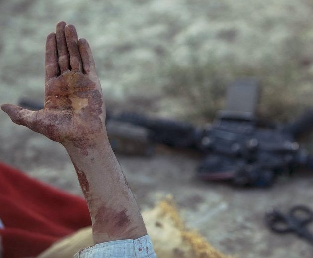 An Afghan villager holds up a blood stained hand to US military soldiers from the 3rd platoon, C-company, 1-23 infantry, before they use a ballistics kit to test for explosive residue on his hands after he was shot because he was suspected of being an insurgent and planting a roadside bomb, in Genrandai village at Panjwai district, Kandahar on September 24, 2012. The wounded man denied being Taliban, an association with which consequently leads to incarceration for the suspect and his family, saying he had been working at a grapevine when he was shot. The Afghan Taliban dismissed NATO figures showing a decrease in insurgent attacks, saying the statistics reflect troop withdrawals and a "cowardly" avoidance of contact. AFP PHOTO/Tony KARUMBA (Photo by TONY KARUMBA / AFP)