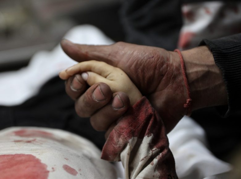 EDITORS NOTE: Graphic content / A relative holds the hand of three-year-old Yahya al-Malahi, who was killed in an Israeli strike ahead of her funeral in Gaza City on April 14, 2026. Gaza's civil defence agency said on April 14 four people, one of them a toddler, were killed in an Israeli strike in the northern part of the Palestinian territory. Violence continues to grip the war-torn Gaza Strip despite a ceasefire which came into effect on October 10, with both Israel and Hamas regularly accusing each other of violations. (Photo by Omar AL-QATTAA / AFP)
